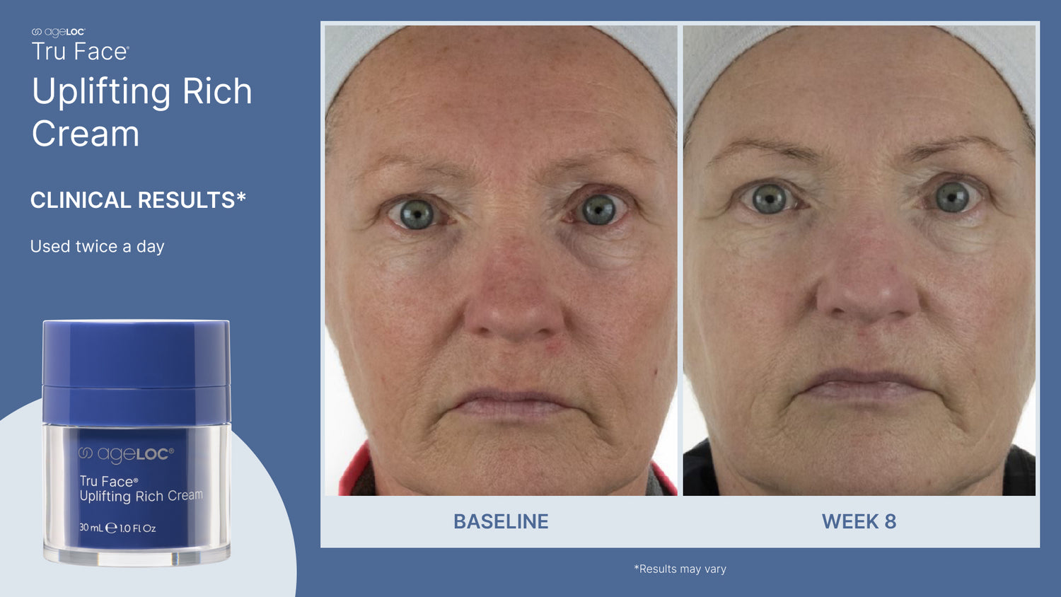 ageLOC Tru Face Uplifting Rich Cream